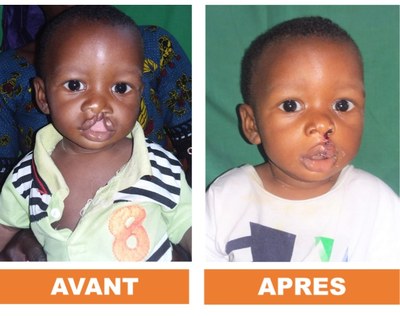 Bouaké hopital (1)