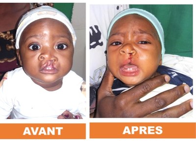 Bouaké hopital (5)
