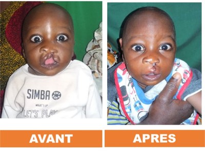 Bouaké hopital (7)